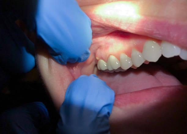 Best Emergency Dentist for Special Needs Patients in Morgan, UT