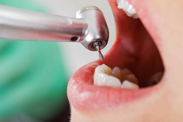 Best Urgent Dental Care for Toothache in Morgan, UT
